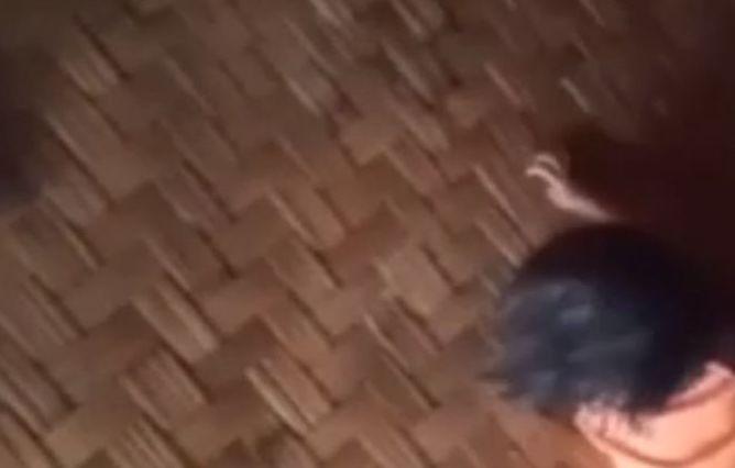 Begini Kondisi Terkini Anak di Sukabumi yang Dianiaya Ayah Kandung