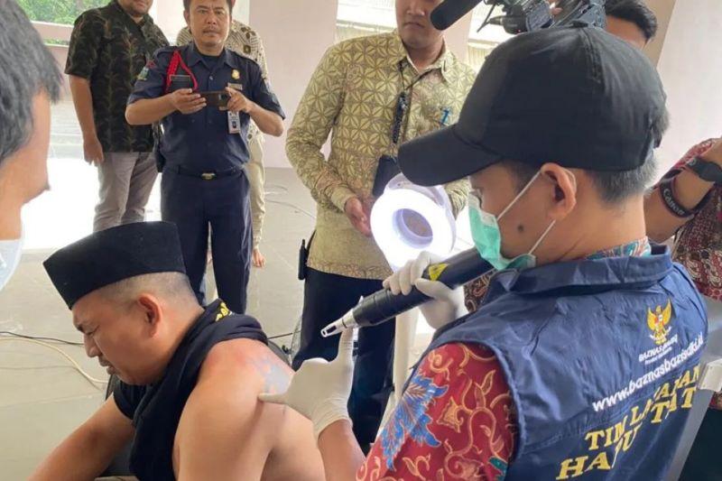 Baznas DKI Sediakan Layanan Gratis Hapus Tato selama Ramadan