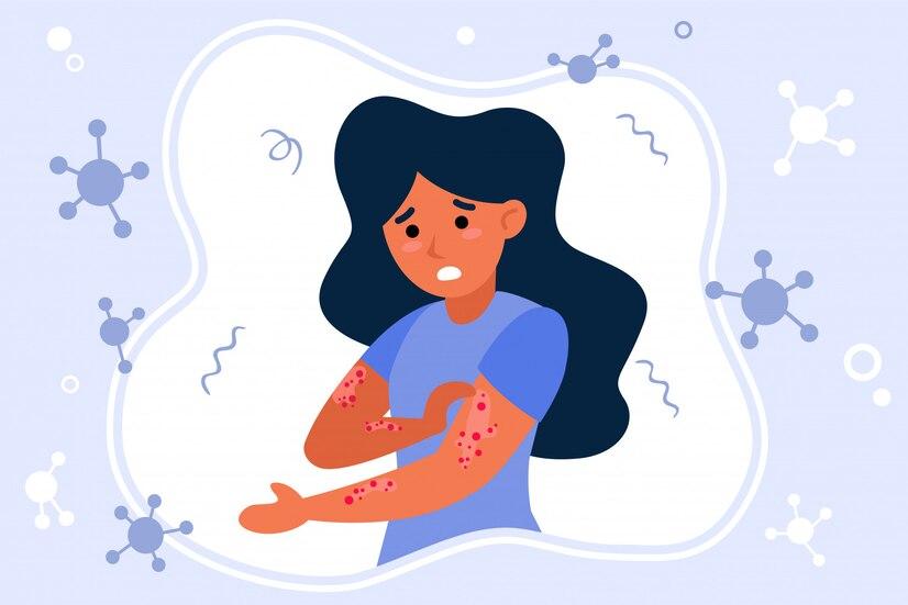 Dokter: Faktor Ras dan Keturunan jadi Risiko Utama Anak Terkena Alergi