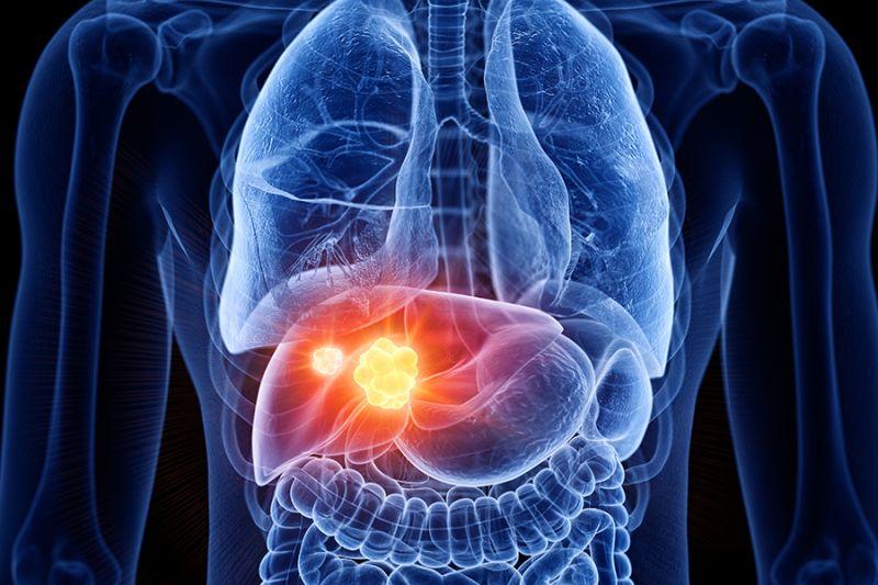 Ingat! Kata Dokter Vaksin Hepatitis B untuk Cegah Kanker Hati