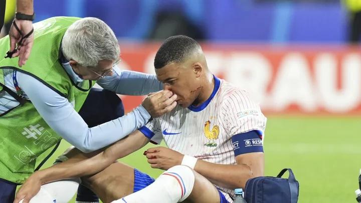 Mbappe Patah Hidung, Netizen Malah Sarankan Pakai Topeng Kura-Kura Ninja