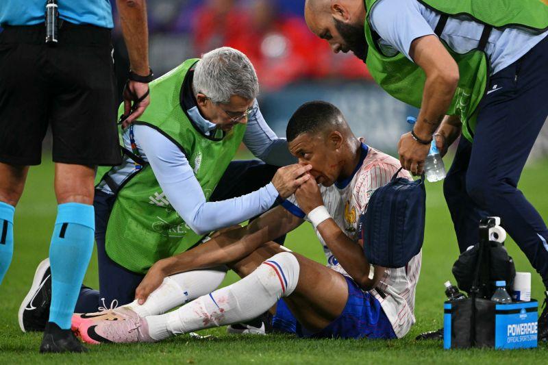Cedera Patah Tulang Hidung saat Game Perdana, Kubu Belanda harap Mbappe Pulih Sebelum Bertemu