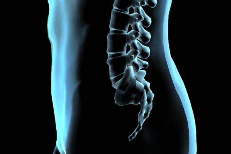 Waspada Gejala-gejala Patah Tulang Tak Wajar, Begini Kata Dokter