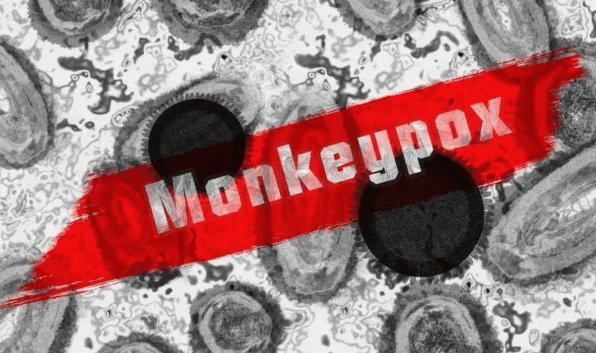 WHO: Virus Mpox dapat Dihentikan