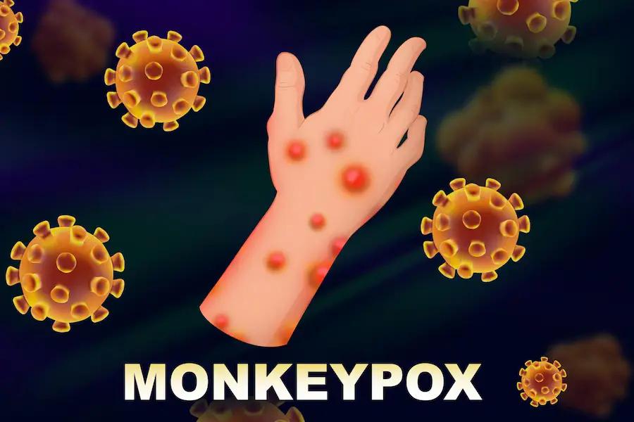Cegah Mpox dengan Menjaga Pola Hidup Bersih
