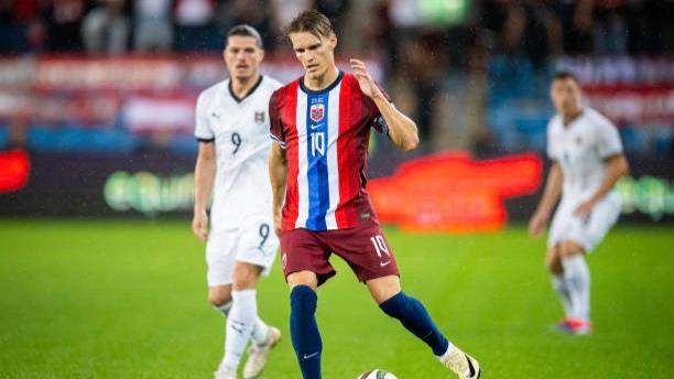 Update Cedera Martin Odegaard, Mikel Arteta Berikan Kabar Terbaru