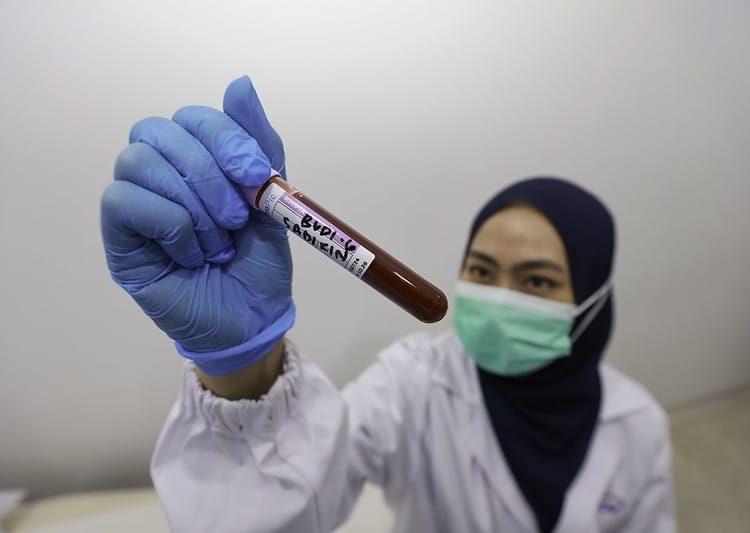 Kemenkes Gencarkan 3 Langkah Mempercepat Produksi Obat Dalam Negeri