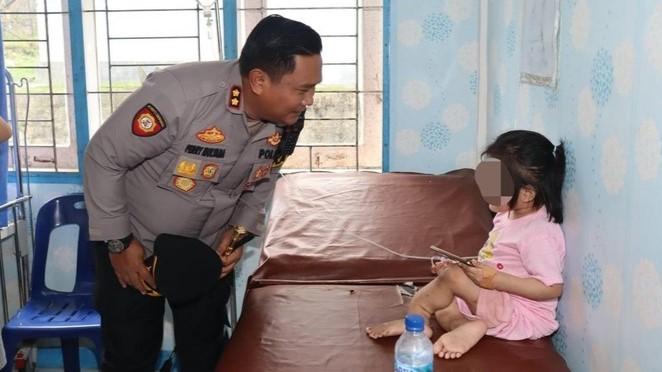 Viral Bocah di Nias Selatan Diduga Dianiaya Keluarga hingga Cacat, Kini Tante jadi Tersangka