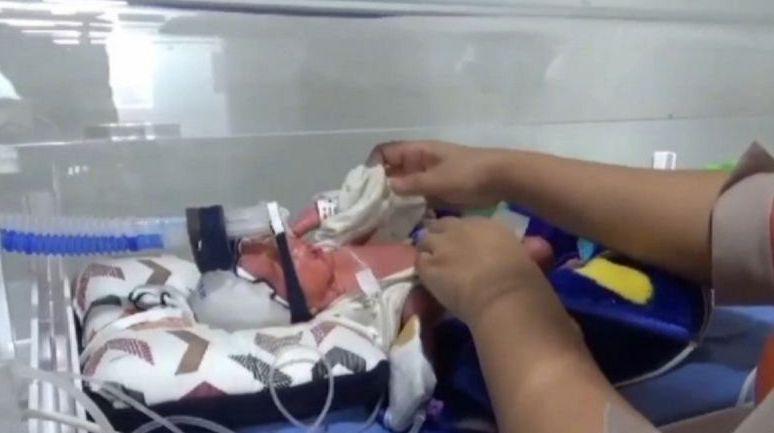 Heboh! Ibu di Jambi Lahirkan Bayi Kembar 4, Awalnya Tahu Cuma 2
