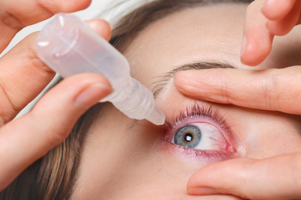 Pakai Obat Tetes Mata Saat Puasa, Apakah Membatalkan?