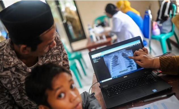 Penyuluhan dan Skrining Rutin Berhasil Turunkan Kasus TBC di Kepulauan Seribu