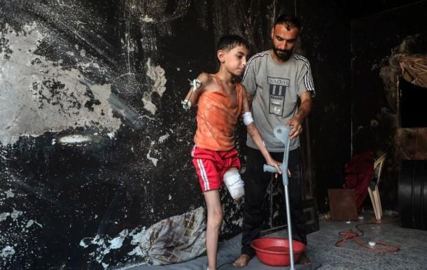 UEA dan WHO Evakuasi 155 Warga Palestina dari Gaza untuk Perawatan Medis di Abu Dhabi