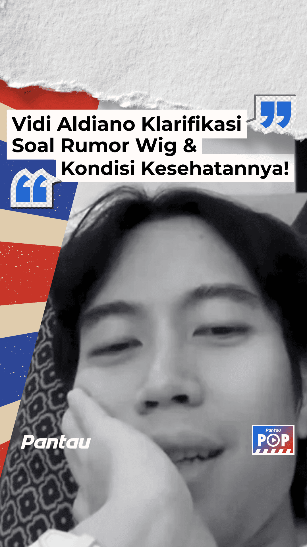 VIDI ALDIANO KLARIFIKASI SOAL RUMOR WIG & KONDISI KESEHATANNYA