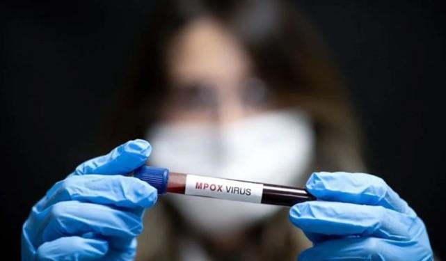 Belanda Konfirmasi Kasus Pertama Varian Baru Mpox, Pasien Tidak Memiliki Riwayat Perjalanan
