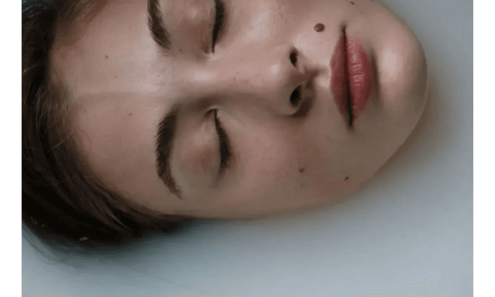 Mahasiswa UMY Kembangkan Alat Deteksi Dini Kanker Kulit Berbasis AI Bernama Scanoma