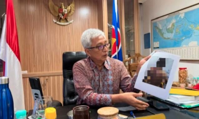 Jerit Pekerja Migran Indonesia Masih Terdengar: Dubes RI di Malaysia Ungkap Kasus Penganiayaan Berat