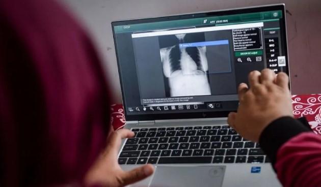Kemenkes Tambah Anggaran 2026 untuk Percepat Deteksi Tuberkulosis dan Kejar Target Nasional
