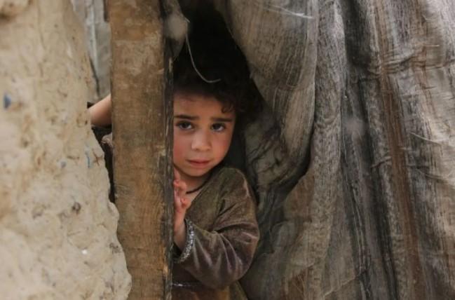 Lebih dari 60 Anak Meninggal karena Malnutrisi di Badakhshan Afghanistan, Hampir 16.000 Kasus Terdata