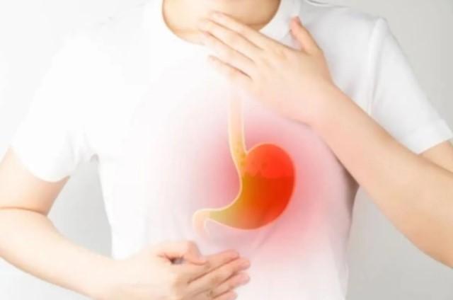 Prof. Rino Gani: Gaya Hidup Sehat Bisa Kurangi Risiko GERD pada Anak Muda