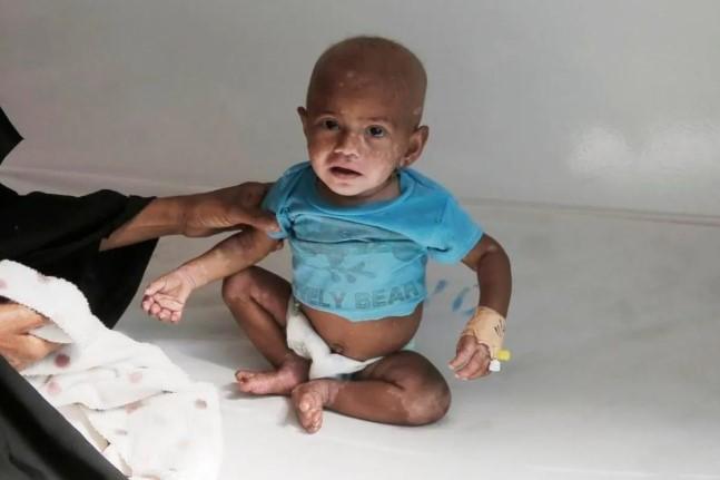 UNICEF Laporkan Kematian Anak Balita Turun Drastis sejak 2000, Namun Laju Penurunannya Melambat