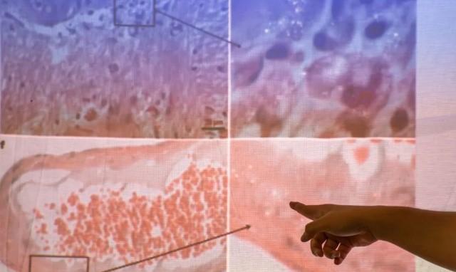 Ahli Kesehatan Bagikan Cara Sederhana Kurangi Paparan Mikroplastik di Rumah Tangga