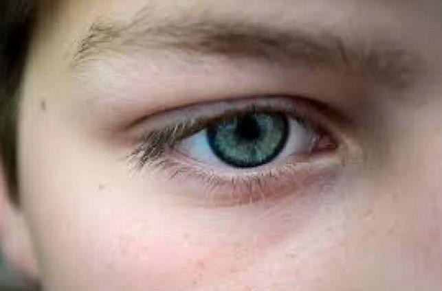 Dokter Ungkap Mata Kedutan Bisa Jadi Tanda Stres dan Perlu Diwaspadai