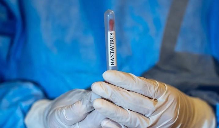 CDC Sebut Hantavirus Sangat Sulit Menular Antar-Manusia