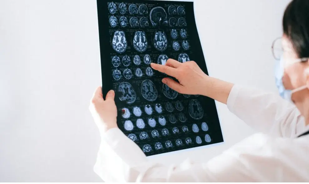 Dokter Ingatkan Gangguan Penglihatan Bisa Menjadi Tanda Awal Tumor Otak