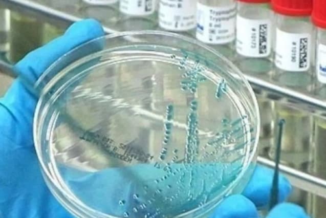 Pemerintah AS Membatasi Pendanaan Riset Gain-of-Function Berisiko Tinggi demi Kurangi Ancaman Biologis