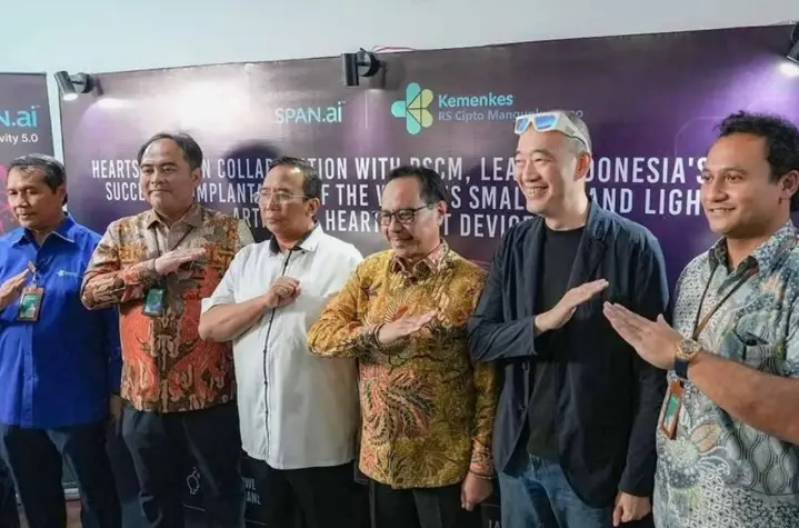 RSCM Berhasil Lakukan Implantasi LVAD Terkecil di Dunia, Jadi yang Pertama di Asia