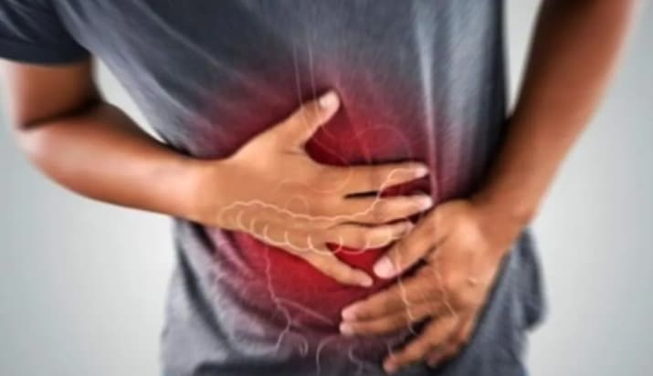 Dokter Ungkap Gejala Perlengketan Usus yang Picu Nyeri Perut dan Kembung serta Cara Penanganannya