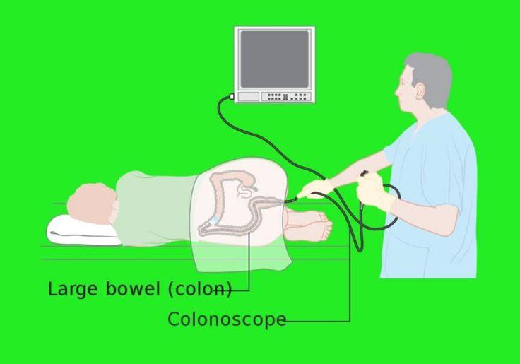 Tes Kesehatan Ini Harus Dilakukan untuk Usia 40 ke Atas