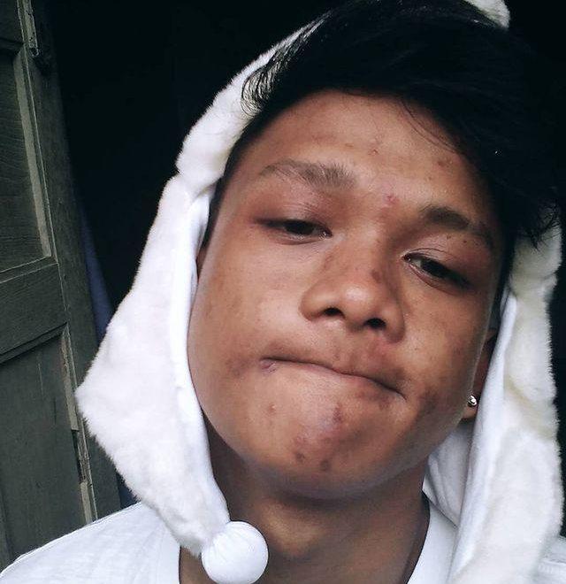 Pemilik Akun @catwomannn Idap HIV Masih Hidup Hingga Sekarang