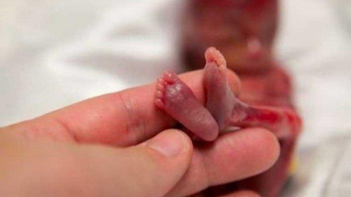 ABG Ngaku Temukan Bayi Dibuang, Ternyata Anak Sendiri
