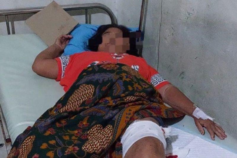 Ngeri! Pasutri di Tabalong Diserang Beruang Liar, Kaki Digigit