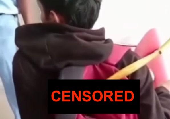 Ngeri! Celurit Masih Nancep di Pundak Pelajar di Tambun