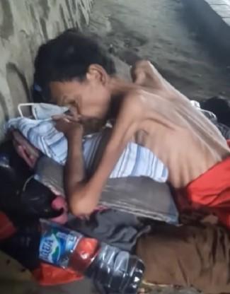 Miris! Bukan di Ethiopia, Manusia Kurus Tulang Dibalut Kulit ini Warga Pinggiran Jakarta