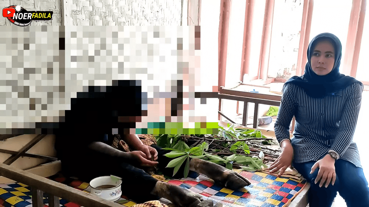 Geger! Pria Ini Kakinya Berubah jadi Kambing Usai Injak Kepala Ibu Kandungnya saat Salat