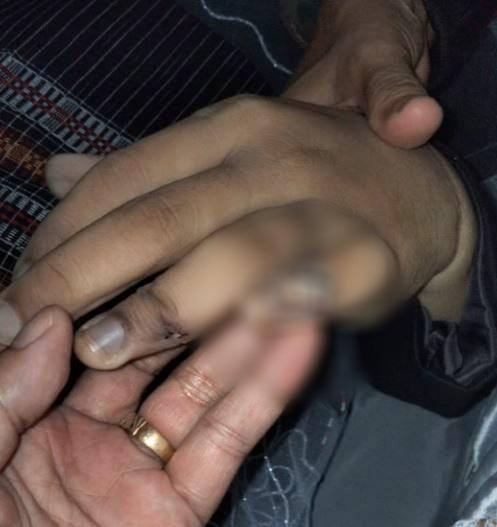 Hendra Kurniawan Sempat Amati Langsung Jasad Brigadir J yang Berlumuran Darah di TKP