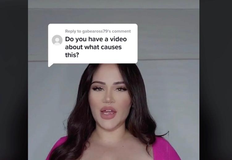 Payudara Wanita Ini Tak Bisa Berhenti Membesar. Kok Bisa?