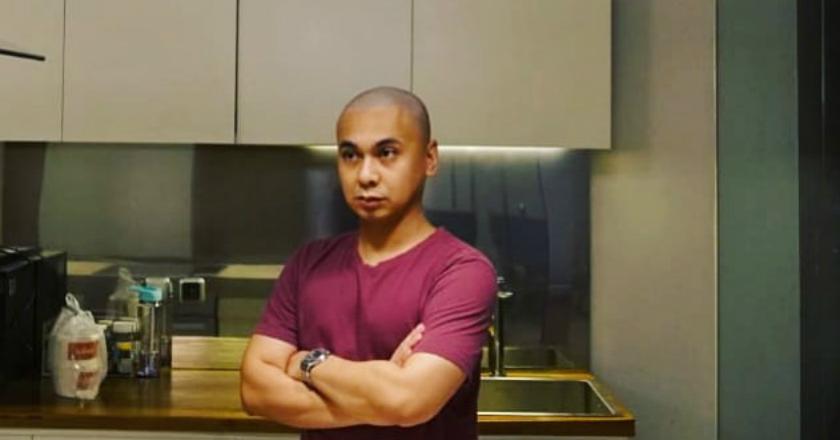 Raditya Dika Pangkas Rambut Botak, Istri Takut Pulang ke Rumah