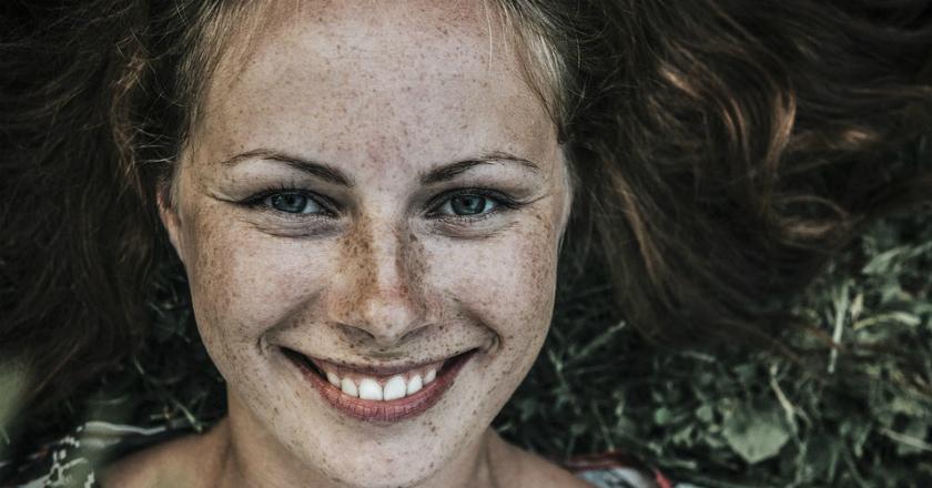 Jadi Tren, Intip Fakta di Balik Kepopuleran Freckles