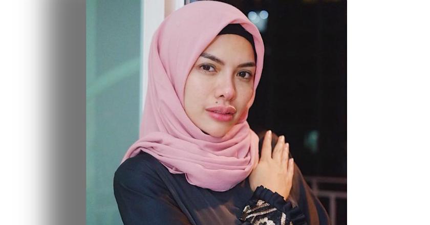 Hasil Visum Dipo Latief Tunjukkan Penganiayaan yang Dilakukan Nikita Mirzani
