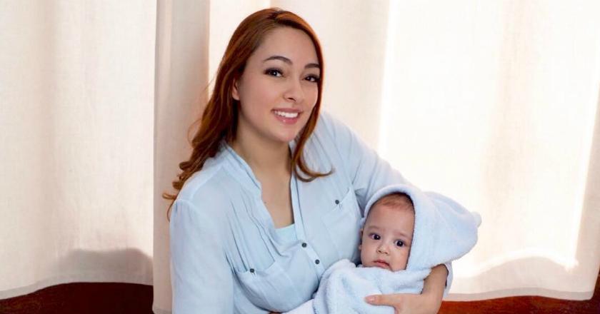 Tips Mengatasi Masalah Kulit Anak Ala Dokter Reisa Broto Asmoro
