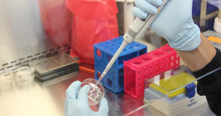 Hanya Bermodal Smartphone dan Air, Ilmuwan Kembangkan Uji Malaria