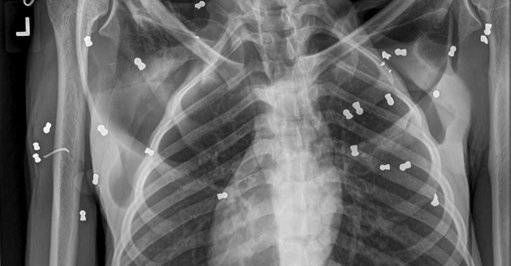 Orang Utan Ditembak, BKSDA Aceh Minta Polisi Terbitkan Senapan Angin