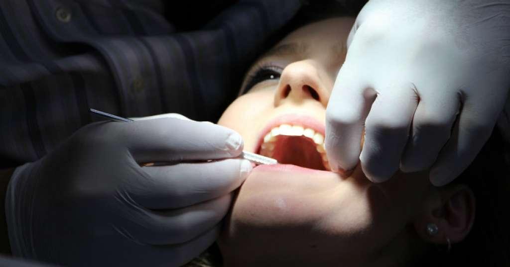 Veneer Tidak Bisa Dilakukan untuk Semua Kondisi Gigi