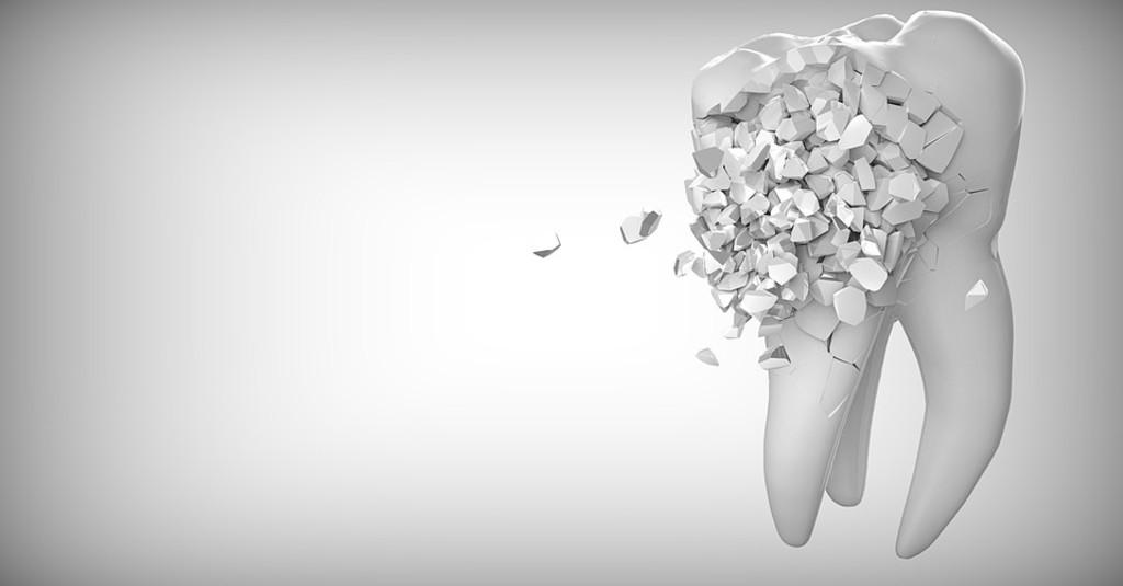 Bermimpi Gigi Copot? Bisa Jadi 5 Hal Buruk Ini Akan Terjadi