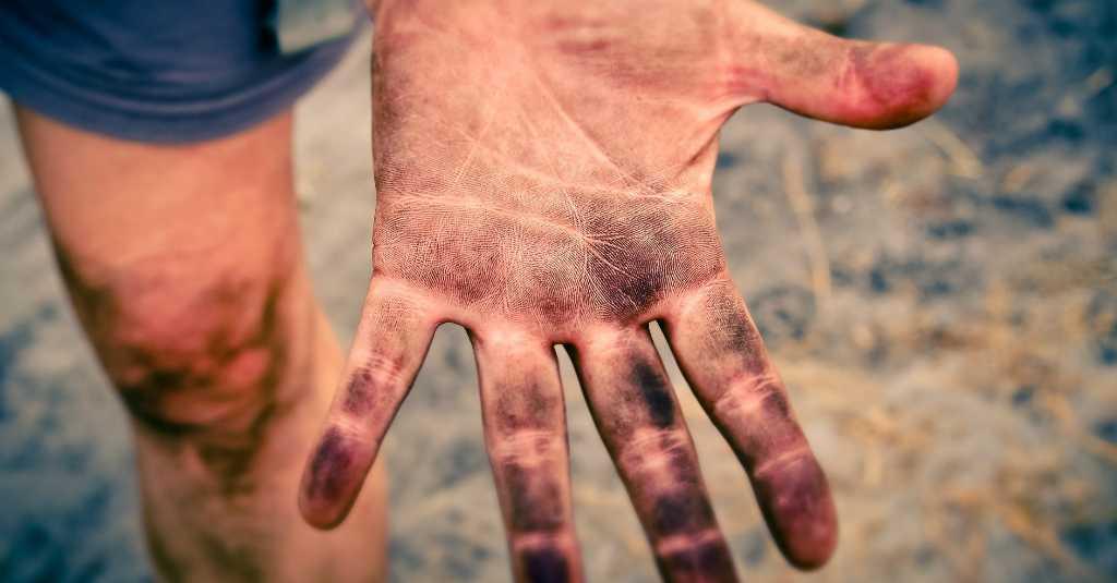 Cukupkah Bersihkan Tangan Hanya Gunakan Hand Sanitizer?