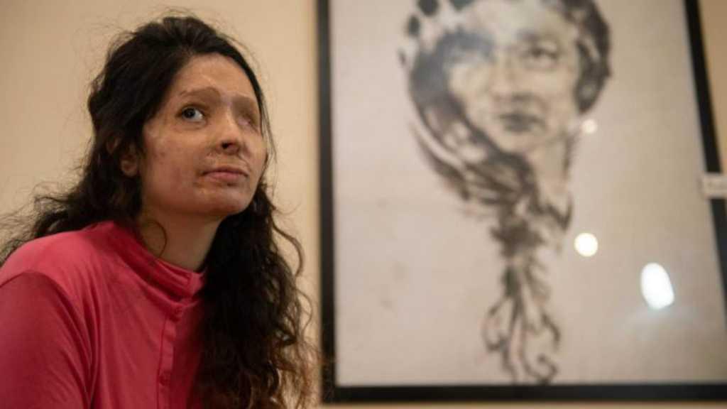 Serangan Asam Cuka di India Kian Mengerikan